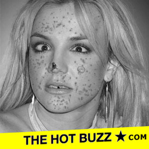 Even Britney Spears has pimples